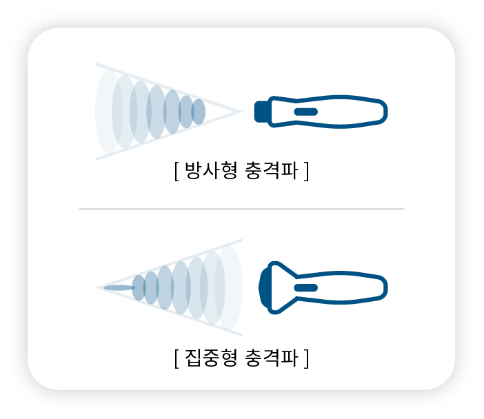체외충격파